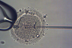 ARTbaby-clinic-Georgia-10