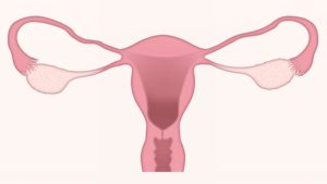 Endometrial Polyp Management and IVF
