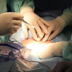 Fertility surgeries